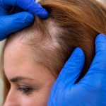 ova-popularna-frizura-mogla-bi-uzrokovati-celavost.webp.webp